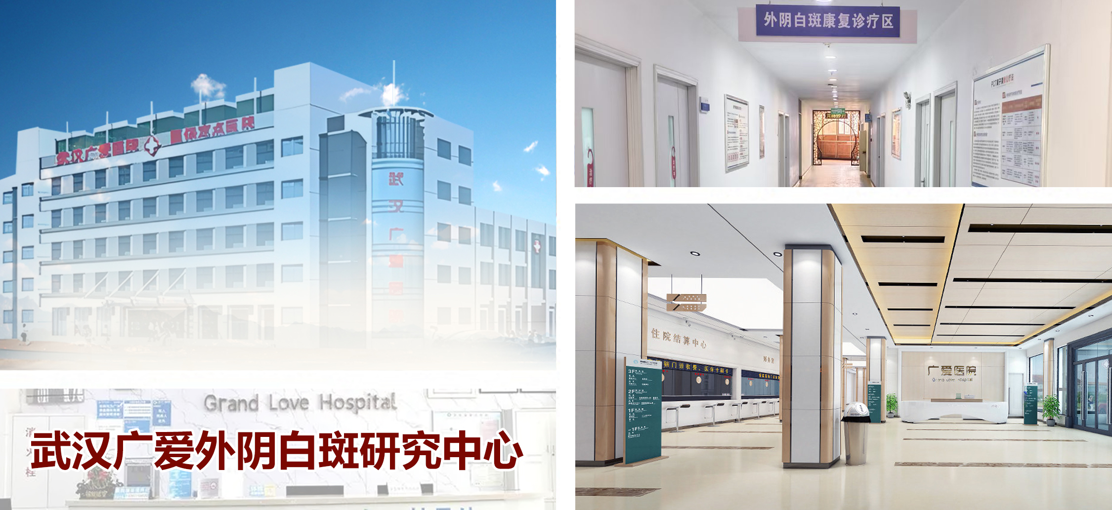 武汉广爱医院-外阴白斑